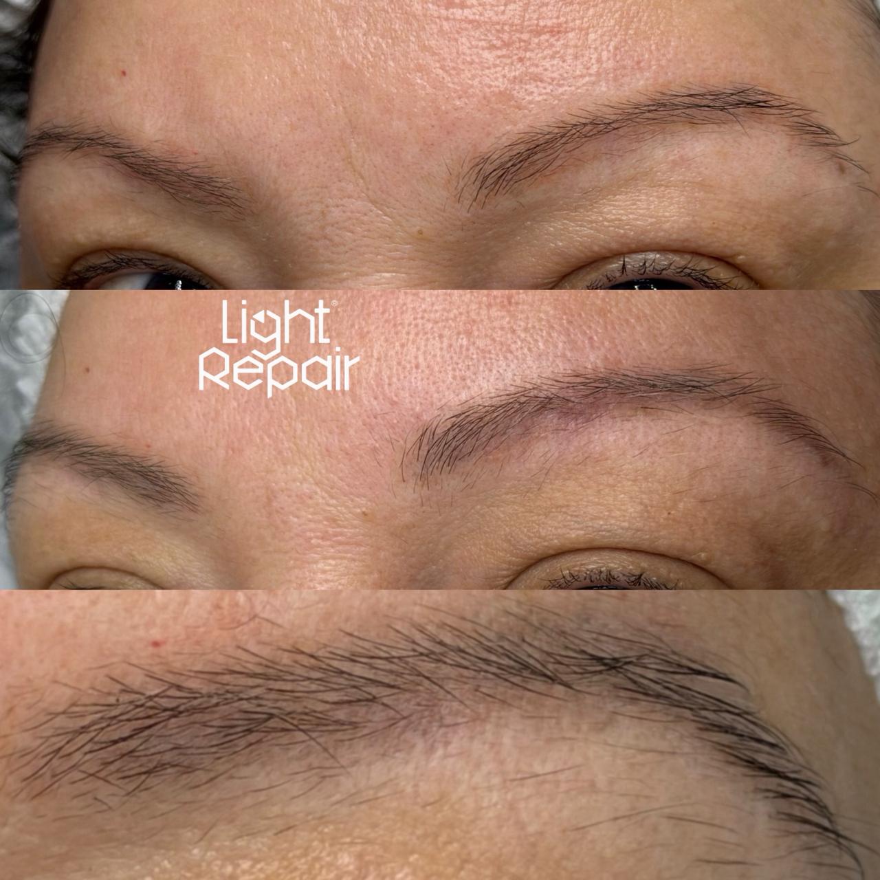 Resultado antes e depois, Light Repair